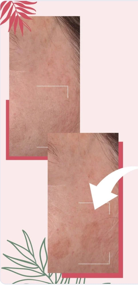 Crème correctrice de pigmentation 100 ml – Formule albanaise anti-taches et unifiante pour le teint